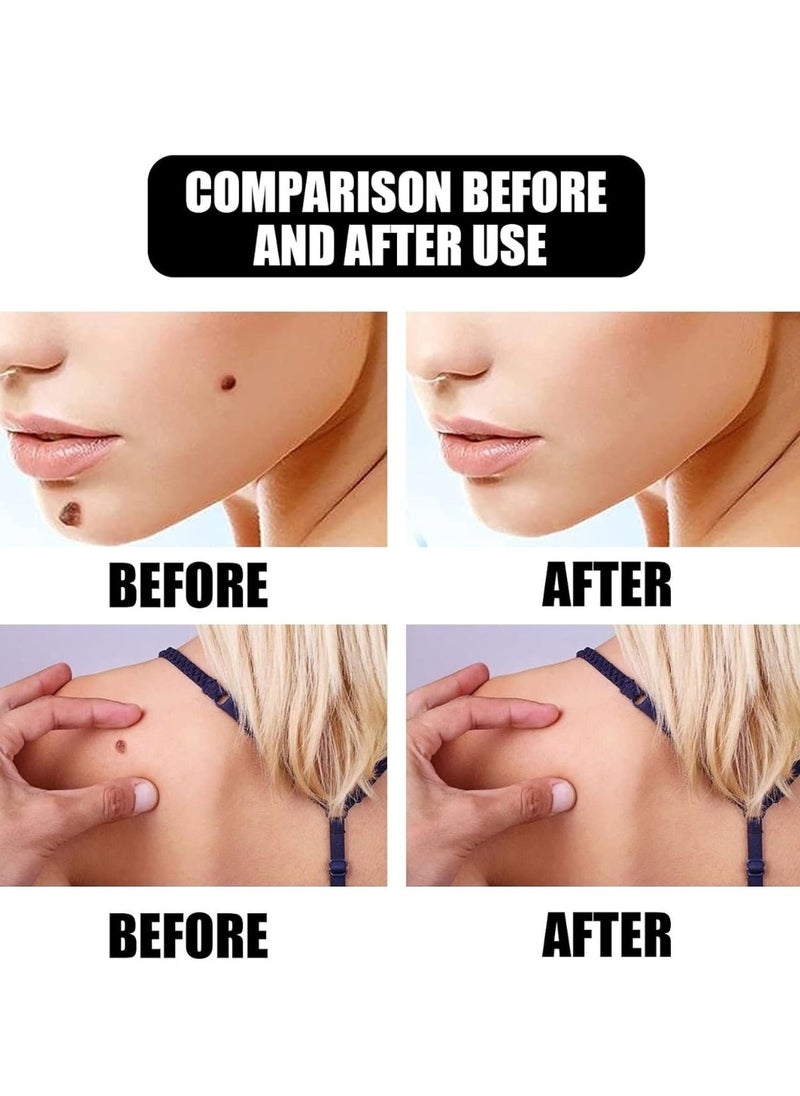 Active Skin Mole Reduce Skin Tag Serum for Face and Body Soften Warts and Skin Tags Remover Liquid with Tea Tree Leaf Oil Skin Tag Removal Serum for Women and Men 10ml