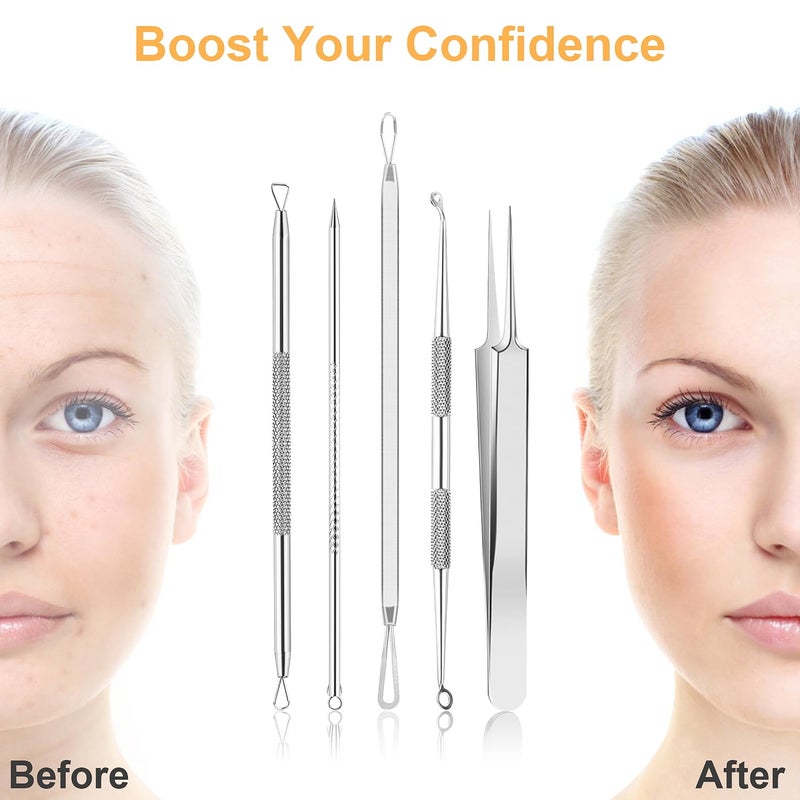 UUBAAR 9 PCS Blackhead Remover Tools, Pimple Popper Tool Kit & Comedone Extractor - Professional Acne, Zit, Blemish & Whitehead Removal for Face & Nose, with Stainless Steel Tweezers & Travel Case, UUBAAR - Image 3