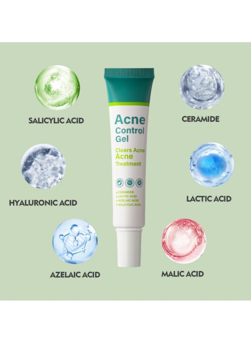 MOOYAM - Acne Treatment Cream,Acne Spot Treatment gel,Clear Acne Spot Treatment Gel,Pimple Cream for Acne Prone Skin Care,Acne Control Gel,Salicylic Acid Acne Treatment Gel,Clear Breakouts, 30g - Image 1