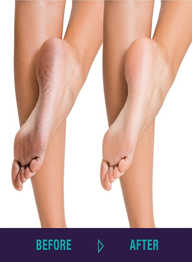 Calitate24 Foot File, Foot Scrubber for Dead Skin, Pedicure Tool, Foot Rasp, Foot Buffer - Image 4