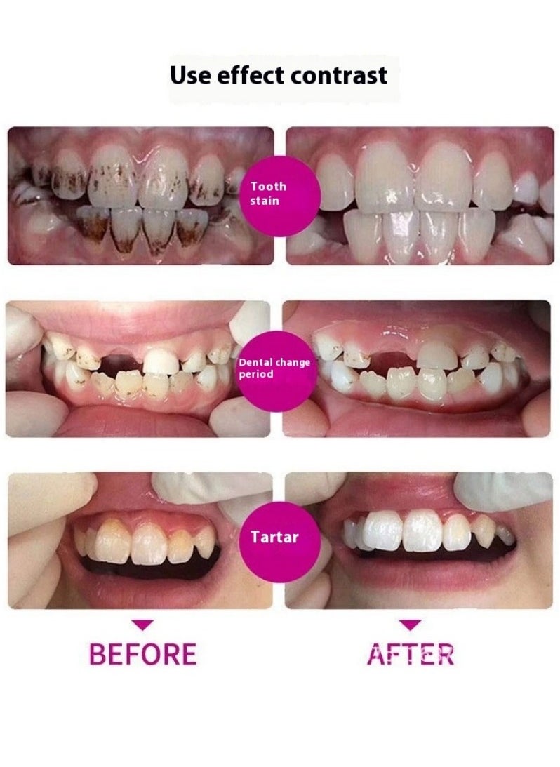 WILD Clean & Polish Paste for Teeth Cleaning, Removes Dental Plaque and Teeth Discoloration with Polishing Effect ，Depurdent New Teeth Whitening Toothpaste ，Deep Cleaning of the Oral Cavity ，Remove Tea Stains Dental Calculus 75ml ﻿  - Image 5