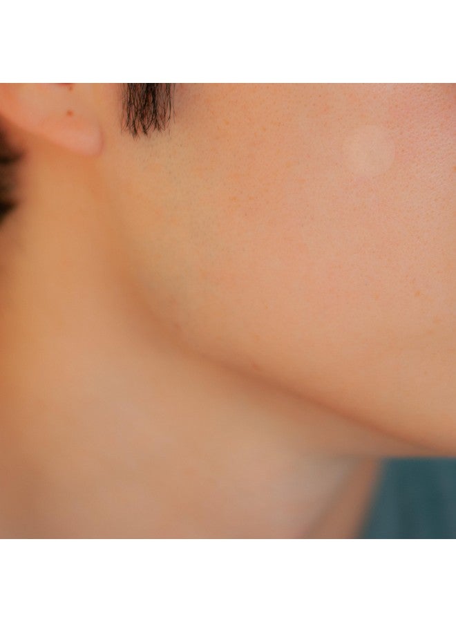 SMARTMED Cover Dot Acne Care (72 Dots) Skin Blemish Treatment With Hydrocolloid | Clear, Waterproof Patch | Oil And Pimple Absorbing | Latexfree - Image 4