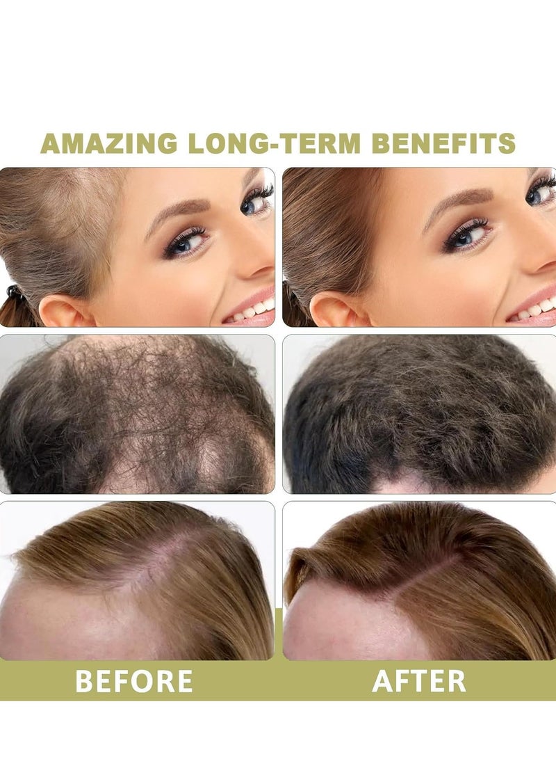 بخاخ ماء إكليل الجبل لنمو الشعر (100 مل) ، معيار وزارة الزراعة الأمريكية ، بخاخ نمو الشعر بالماء المقطر العضوي الطبيعي 100٪ ، خالي من السيليكون ، خالي من الزيوت ، يقلل من تساقط الشعر ، يصلح الشعر التالف - Image 2