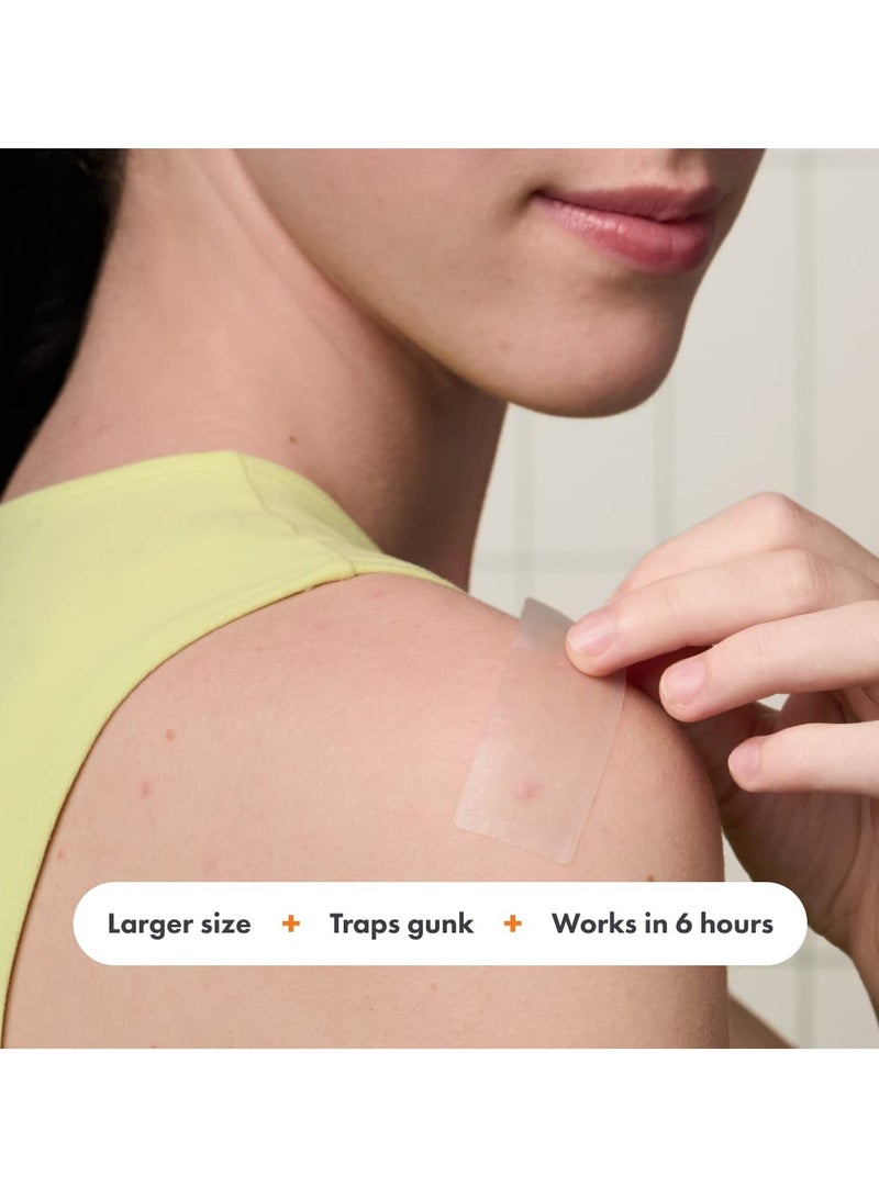 Mighty Patch Surface from Hero Cosmetics - Hydrocolloid Spot Patch for Body, Cheek, Forehead, and Chin, Vegan-friendly (10 Count) - Image 3