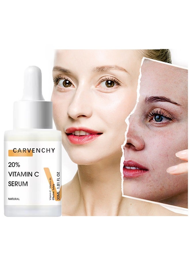 CARVENCHY 20% Vitamin C Serum - Essence Freckle Removing and Anti-Aging - Image 1