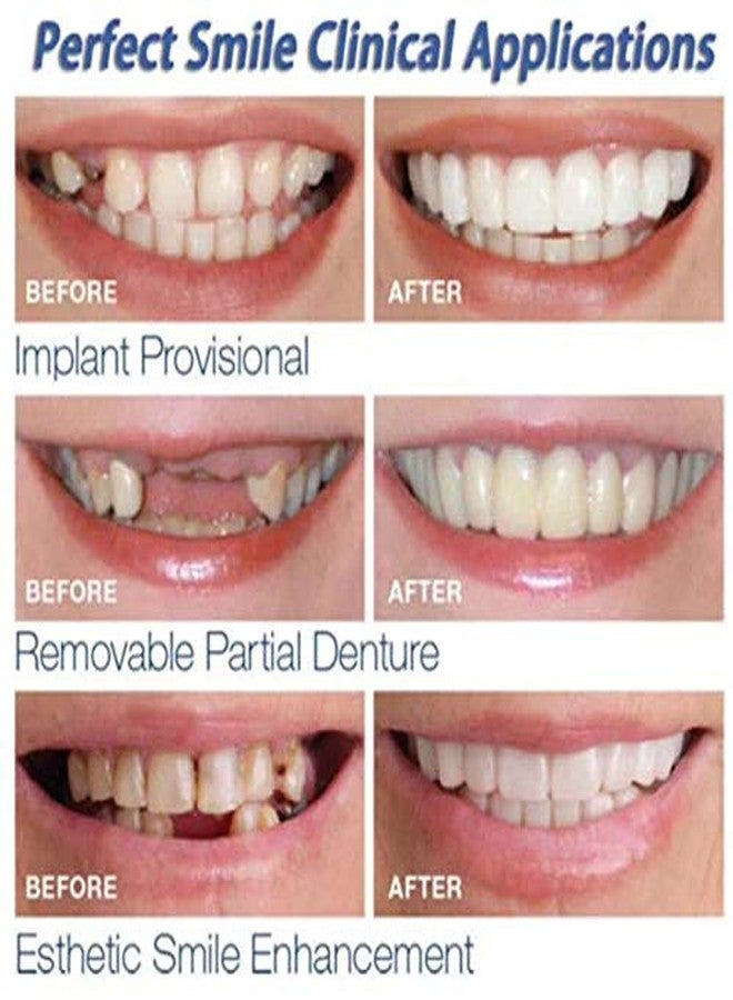 Shopify Upper and lower False teeth cover Perfect Smile Veneers Comfort Fit Flex Denture - Image 3