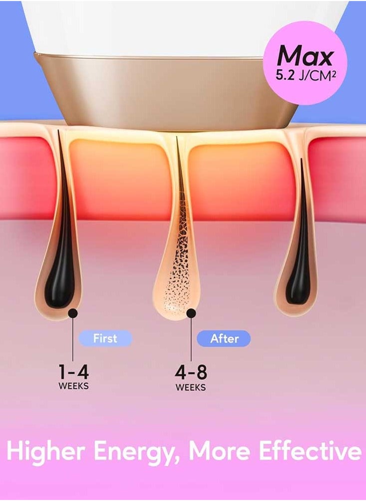 Bosidin Permanent Hair Remover At Home, Upgraded High Energy Levels Laser Hair Removal For Women And Men, 999K Flashes Effective And Safe For Whole Body  - Image 3