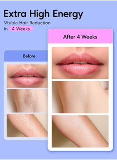 Bosidin Permanent Hair Remover At Home, Upgraded High Energy Levels Laser Hair Removal For Women And Men, 999K Flashes Effective And Safe For Whole Body  - Image 5
