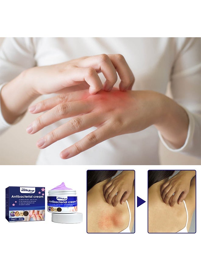 ساوث مون كريم مضاد للبكتيريا ، كريم للحكة للبشرة ، كريم مضاد للحكة لدغة البعوض ، قطعة أثرية مضادة للحكة 30 جرام - Image 3