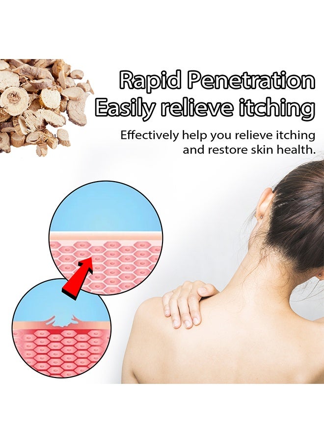 ساوث مون كريم مضاد للبكتيريا ، كريم للحكة للبشرة ، كريم مضاد للحكة لدغة البعوض ، قطعة أثرية مضادة للحكة 30 جرام - Image 5