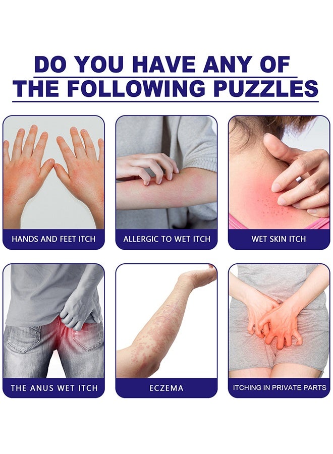 ساوث مون كريم مضاد للبكتيريا ، كريم للحكة للبشرة ، كريم مضاد للحكة لدغة البعوض ، قطعة أثرية مضادة للحكة 30 جرام - Image 4