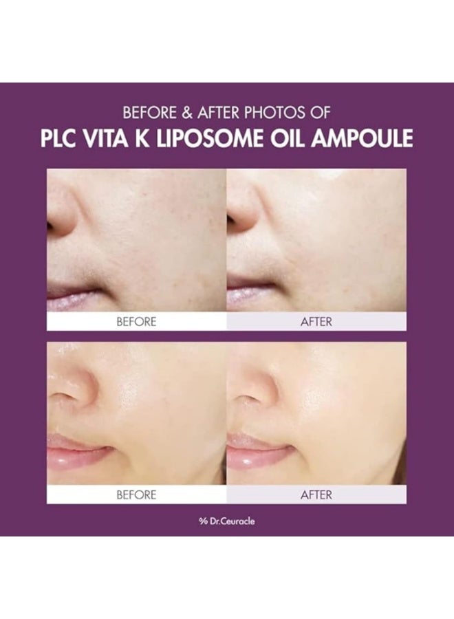Dr. Ceuracle PLC Vitamin K Liposome Oil AmpouleㅣSpecial Care for Toning, Glowing, Hydration, BrighteningㅣSkin-Friendly Water&Oil Layer FormulaㅣSerum for Dark AreaㅣDr.Ceuracle - Image 5