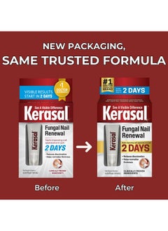 Kerasal Kerasal Nail Renewal, Restores Appearance of Discolored or Damaged Nails, 0.33 fl oz (Packaging May Vary)  - Image 5