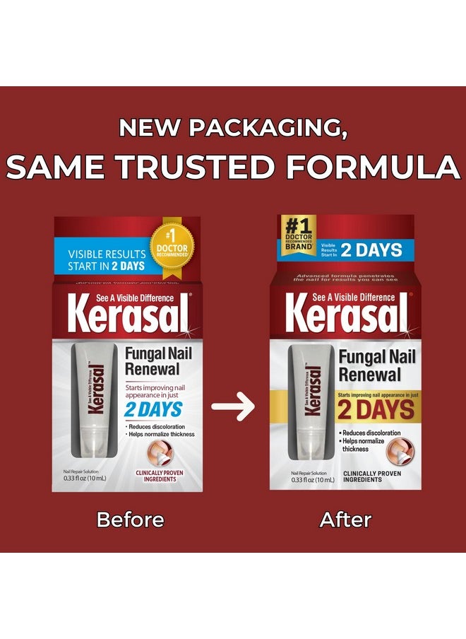 Kerasal Kerasal Nail Renewal, Restores Appearance of Discolored or Damaged Nails, 0.33 fl oz (Packaging May Vary)  - Image 5