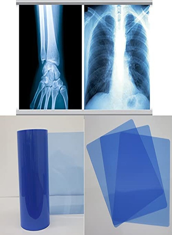 GMP Inkjet Medical Blue Film for X Ray imaging/Waterproof Film/SIZE: 203mm x 254mm (8 inch X 10 inch) X 100 Sheet Pack of 280 GSM / 210 Micron compatible with Canon, Epson Printers - Image 4