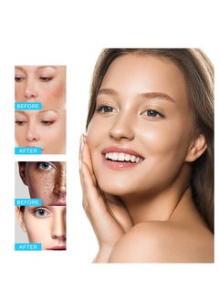 iBealee Dark Spot Remover Whitening Freckle Cream Fades Dark Spots And Evens Skin Tone Brightens Complexion Freckle Remover Brightening Deep Moisturizing Dark Spot Corrector 20g  - Image 4