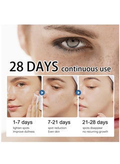 iBealee Dark Spot Remover Whitening Freckle Cream Fades Dark Spots And Evens Skin Tone Brightens Complexion Freckle Remover Brightening Deep Moisturizing Dark Spot Corrector 20g  - Image 5