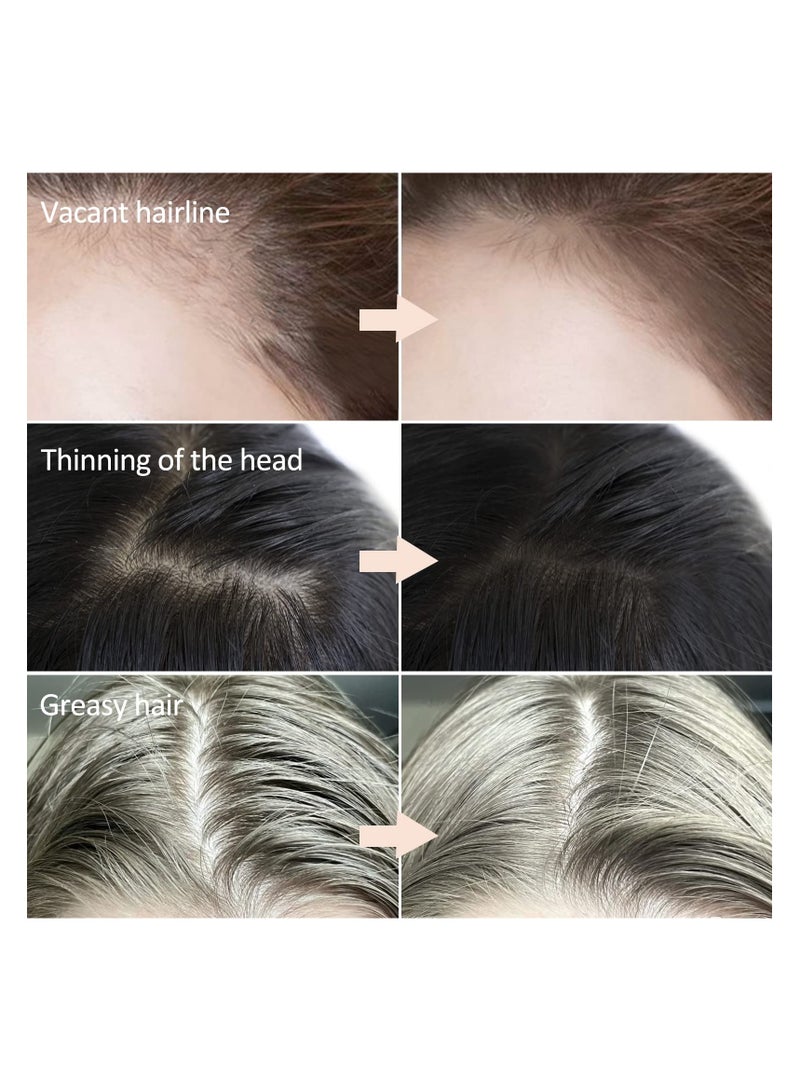 SYOSI Thin Hair Powder, Hair Powder for Thin Hair, Hair Root Dye, Root Touch Up Powder, Hair Shadow Cover Hair Loss Instantly, Hairline Powder for Women Men, Hair Touch-Up - Image 2