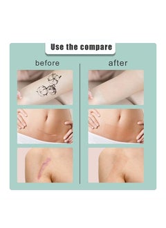 SOUTH MOON Complexion Concealer Patches - Skin Scar Tattoos Acne Scar Patches - Waterproof Complexion Patches  - Image 5