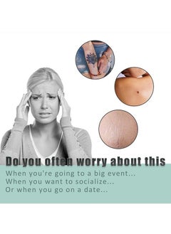 SOUTH MOON Complexion Concealer Patches - Skin Scar Tattoos Acne Scar Patches - Waterproof Complexion Patches  - Image 4