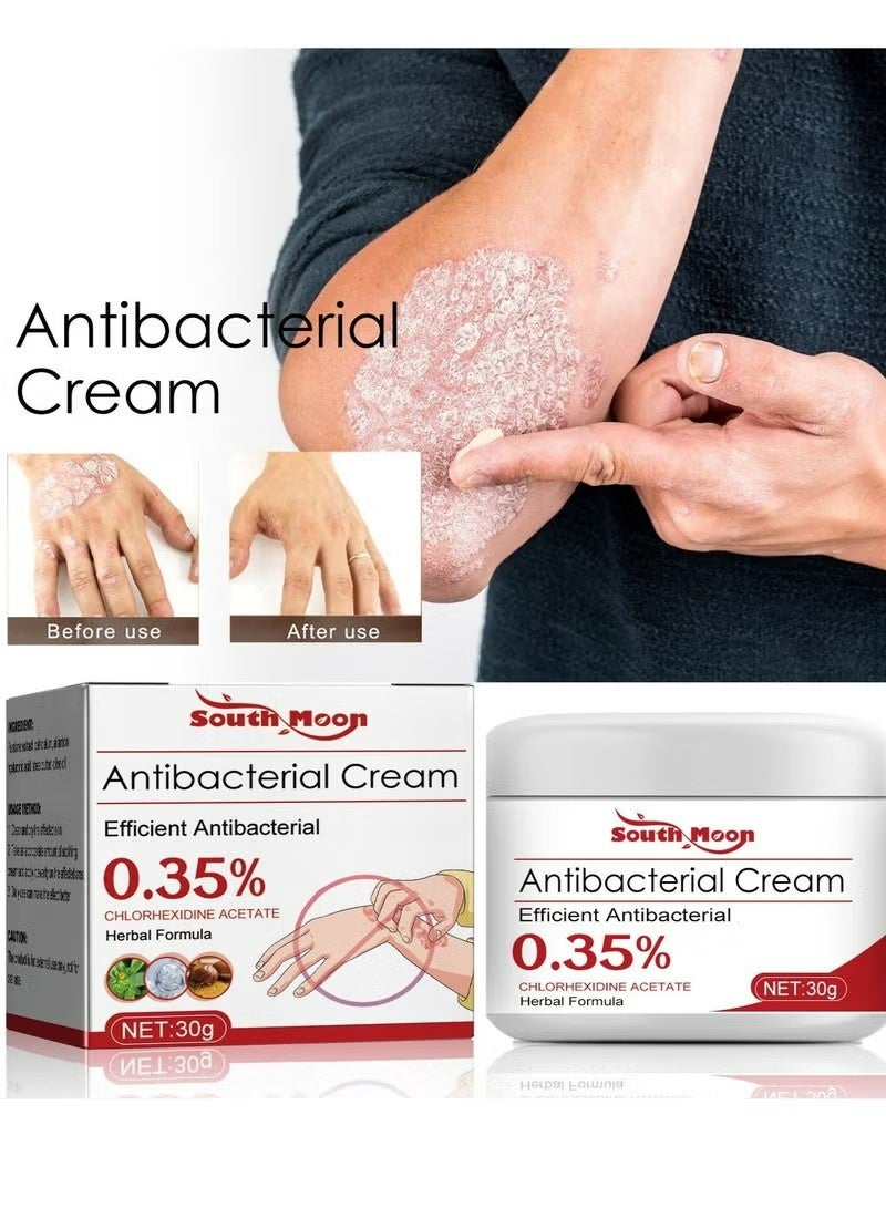 SOUTH MOON Antibacterial Cream,Psoriasis Cream，Natural Chinese Herbal Eczema Psoriasis Creams Dermatitis and Eczema Pruritus Psoriasis Ointment，Psoriasis Creams - Psoriasis Treatment, Antibacterial Cream,for Body Itching 30g - Image 2