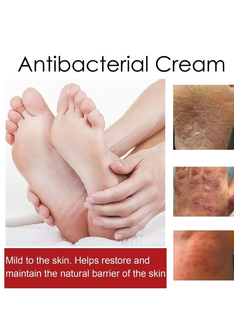 SOUTH MOON Antibacterial Cream,Psoriasis Cream，Natural Chinese Herbal Eczema Psoriasis Creams Dermatitis and Eczema Pruritus Psoriasis Ointment，Psoriasis Creams - Psoriasis Treatment, Antibacterial Cream,for Body Itching 30g - Image 5