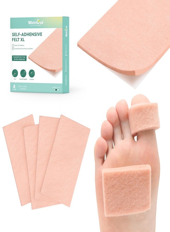 Welnove Chiropody Felt, Self Adhesive Felt Pads for Foot Pain – Instant Relief for Painful Rubbing, Ideal for Blister Prevention, Bunions, Calluses & Discomfort - 4 Pack - Image 1