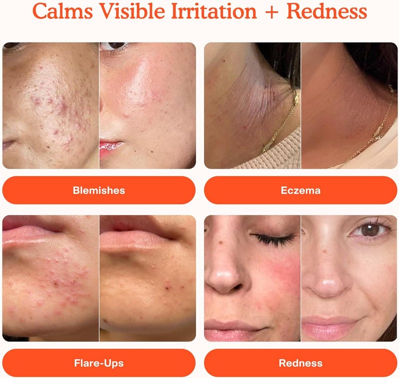 Tower 28 SOS Daily Rescue Facial Spray | Soothing and Refreshing pH Balancing Toner | Hypochlorous Acid Designed for Sensitive Skin 120ml - Image 2