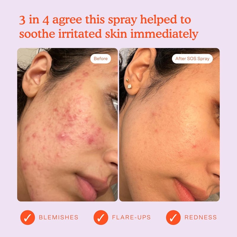 Tower 28 SOS Daily Rescue Facial Spray | Soothing and Refreshing pH Balancing Toner | Hypochlorous Acid Designed for Sensitive Skin 120ml - Image 4