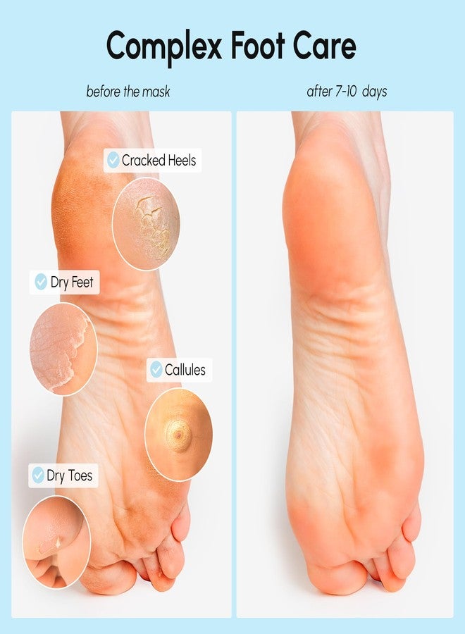 MAREE Foot Peeling Mask – 3-in-1 Foot Mask for Dry Cracked Feet, Callus Remover – Dead Skin Exfoliating Foot Peel Mask with Glycolic Acid – Moisturizing Socks for Men – Spa Self Care Gifts for Women - Image 3