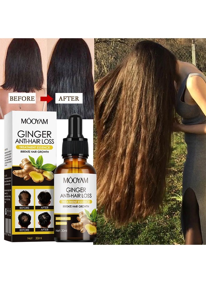 MOOYAM Ginger Anti-Hair Loss Treatment Essence,Hair essence-Plant Ginger Hair Growth Serum Ginger Nutrition Hair Care For Women & Men 30ml  - Image 1