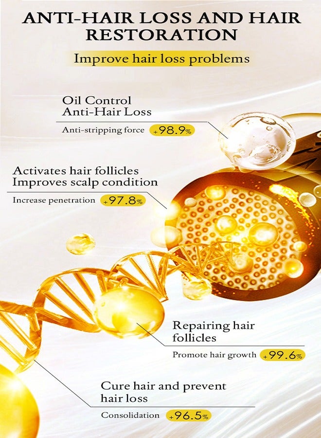 Ginger Anti-Hair Loss Treatment Essence,Hair essence-Plant Ginger Hair Growth Serum Ginger Nutrition Hair Care For Women & Men 30ml