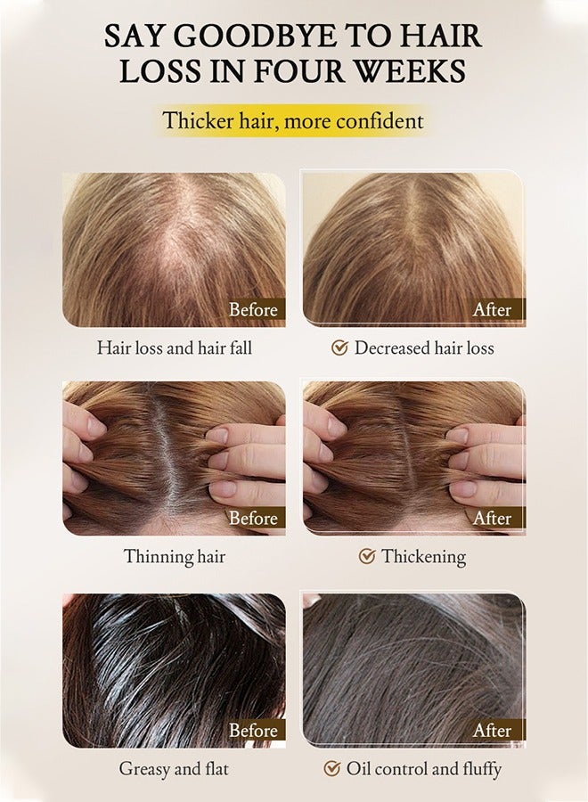 Ginger Anti-Hair Loss Treatment Essence,Hair essence-Plant Ginger Hair Growth Serum Ginger Nutrition Hair Care For Women & Men 30ml