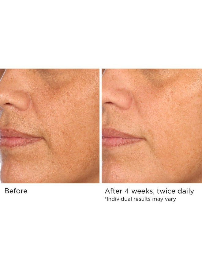 nassif md NassifMD Hydro-Screen - Clinical Grade Serum with Premium Ingredients: Ceramides, Retinol, Bakuchiol, Hyaluronic Acid - Anti Aging Treatment - Image 4