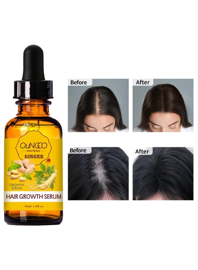 DBEAUTYM Collagen Hair Treatment Hair Mask & Hair Growth Serum,Deep Conditioner Hydrating Hair Mask for Dry Damaged Hair,Hair Growth Oil for Hair Loss,Natural Hair Regrowth Treatment for Men and Women - Image 3