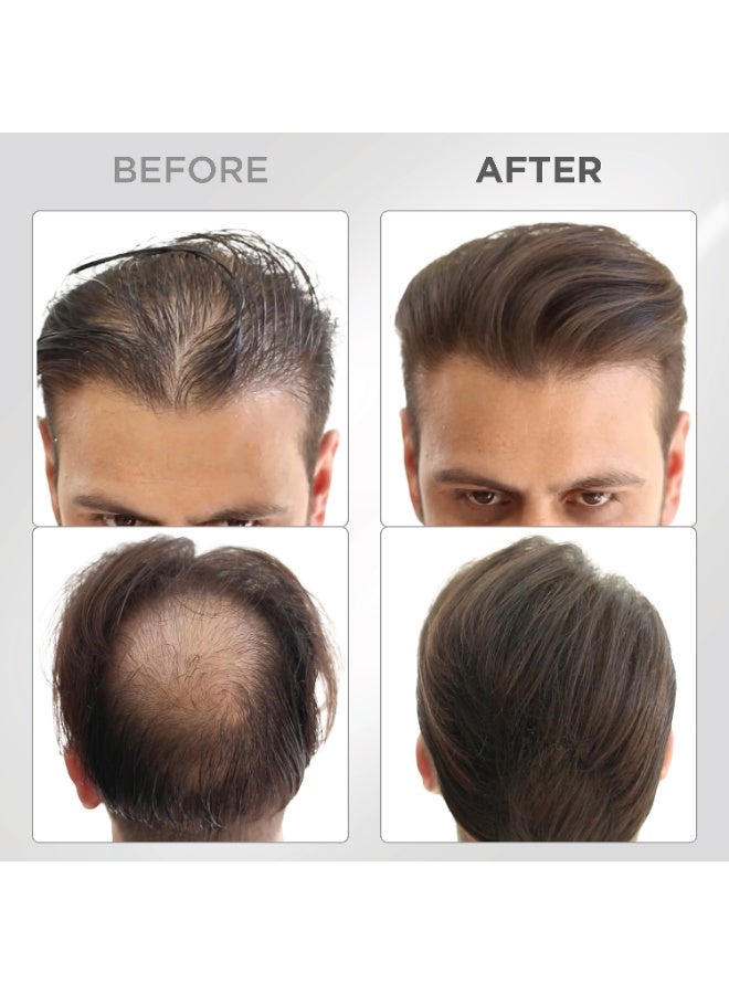 THICK FIBER Hair Fibers for Thinning Hair & Bald spots (Dark Brown) - 25g Bottle - Conceals Hair Loss in Seconds - Hair Powder for Women & Men - Image 3