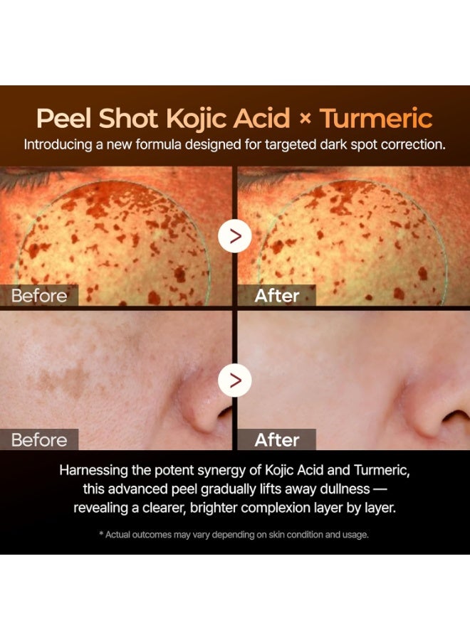دكتور ميلاكسين سيروم Dr. Melaxin Peel Shot Kojic Acid Turmeric | مصحّح للبقع الداكنة بتقشير يحتوي على AHA/BHA ونياسيناميد | سيروم لتفتيح البشرة وتوحيد لونها | 80 مل - Image 3
