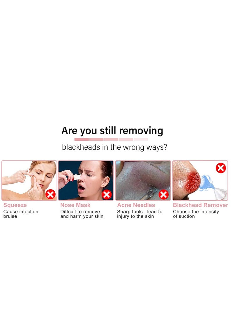 Generic - Ultrasonic Skin Scrubber Peeling Blackhead Remover Deep Face Cleaning Ultrasonic Ion Ance Pore Cleaner Facial Shovel Cleanser - Image 1