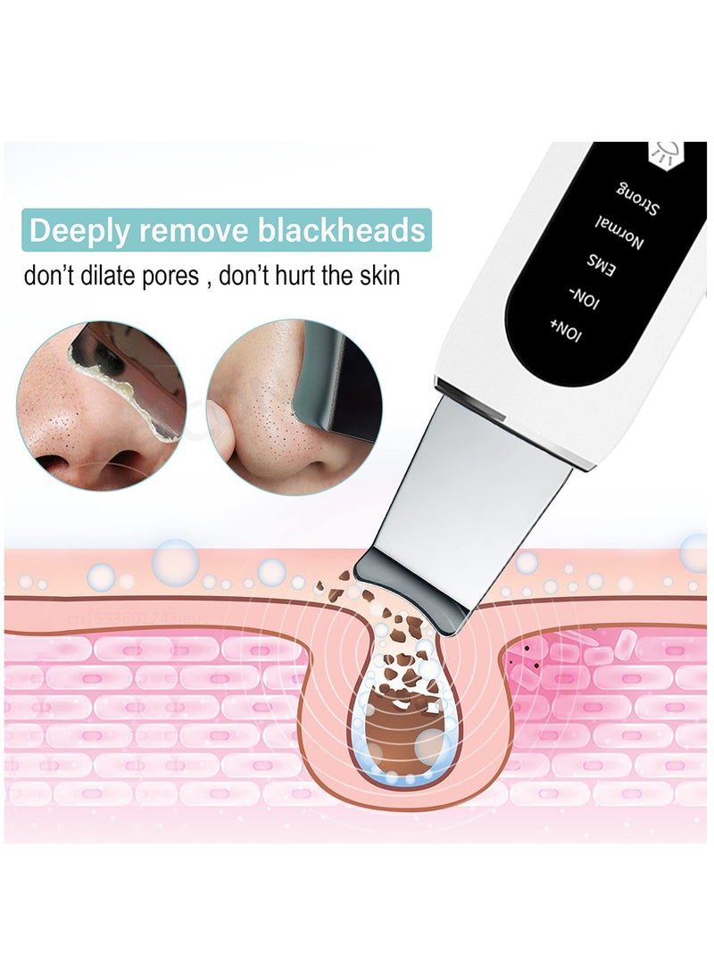 Generic - Ultrasonic Skin Scrubber Peeling Blackhead Remover Deep Face Cleaning Ultrasonic Ion Ance Pore Cleaner Facial Shovel Cleanser - Image 1