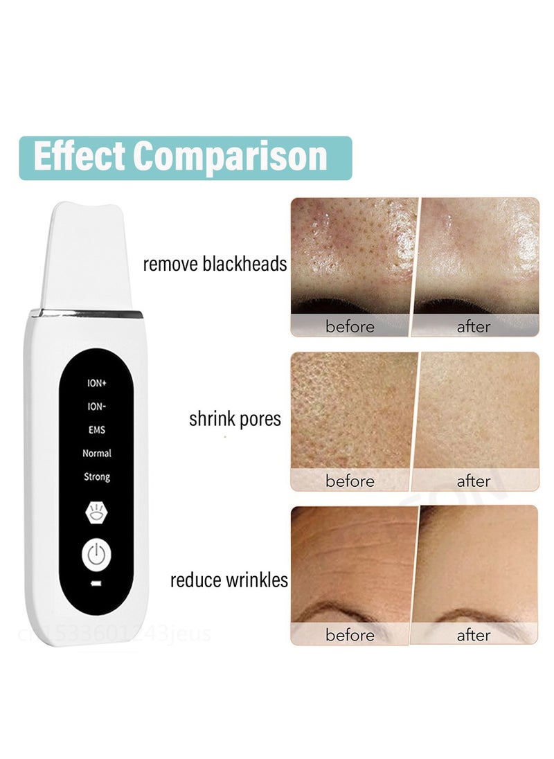 Generic - Ultrasonic Skin Scrubber Peeling Blackhead Remover Deep Face Cleaning Ultrasonic Ion Ance Pore Cleaner Facial Shovel Cleanser - Image 1