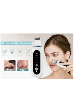 Ultrasonic Skin Scrubber Peeling Blackhead Remover Deep Face Cleaning Ultrasonic Ion Ance Pore Cleaner Facial Shovel Cleanser