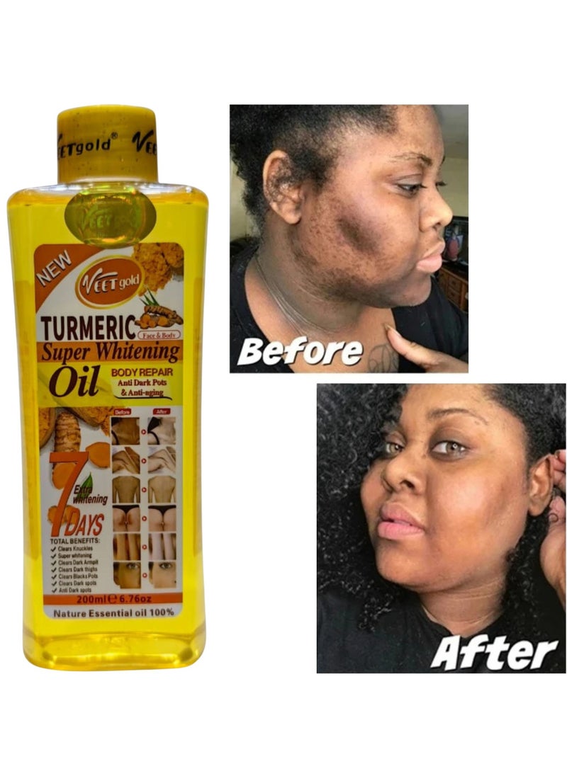 Veet gold Turmeric Super Whitening Oil 200ML, Dark Spot Remover, Dark Knuckles Clear Oil, Anti-aging Body Oil, Reduce Armpit Marks, Clear Bikini Area Marks, Clean Private Parts Men Women Massage Oil 6.76 Oz  - Image 1