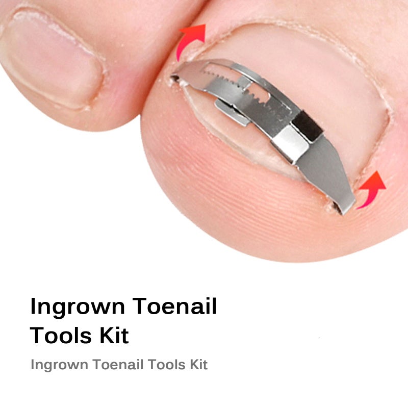 Ingrown Toenail Tools Kit for Ingrown Toenail Removal Correction Toe Nail Corrector & Tape Toenail Treatment Foot Care Tool - Image 5