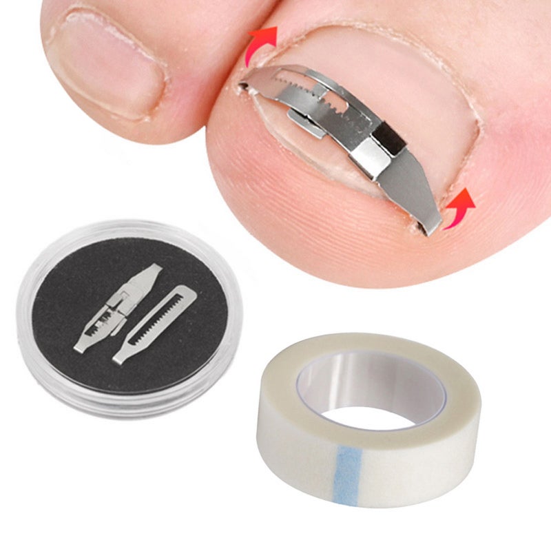 Ingrown Toenail Tools Kit for Ingrown Toenail Removal Correction Toe Nail Corrector & Tape Toenail Treatment Foot Care Tool - Image 3