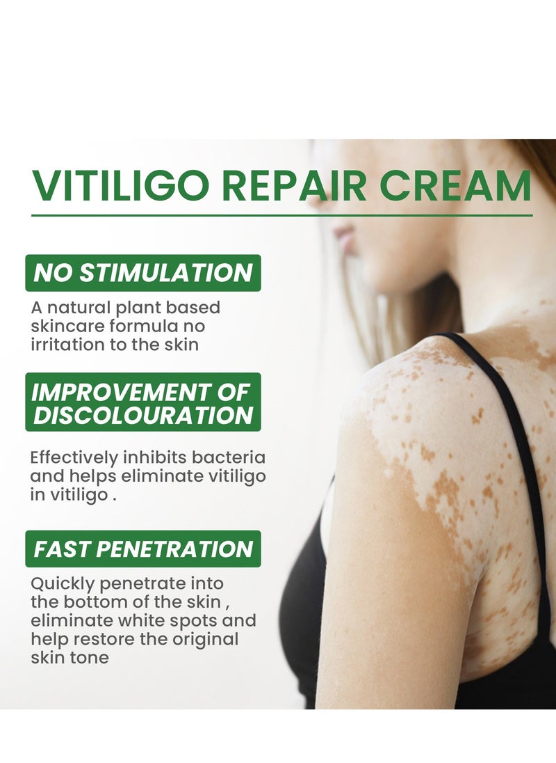 EELHOE Vitiligo Repair and Revitalizing Cream, Vitiligo Treatment Soothing Cream, Vitiligo Treatment Cream, Effectively Improve Skin Pigmentation and Lighten Vitiligo, Reduce White Spots 15g - Image 5