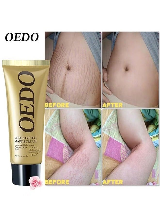 OEDO Rose Stretchmarks Cream 40g Maternity Skin Treatment Pregnancy Scars Repair, Can Promote Cell Regeneration, Repair Necrotic Cells and Enhance Skin Elasticity, Designed For Mother's Stretch Marks - Image 1