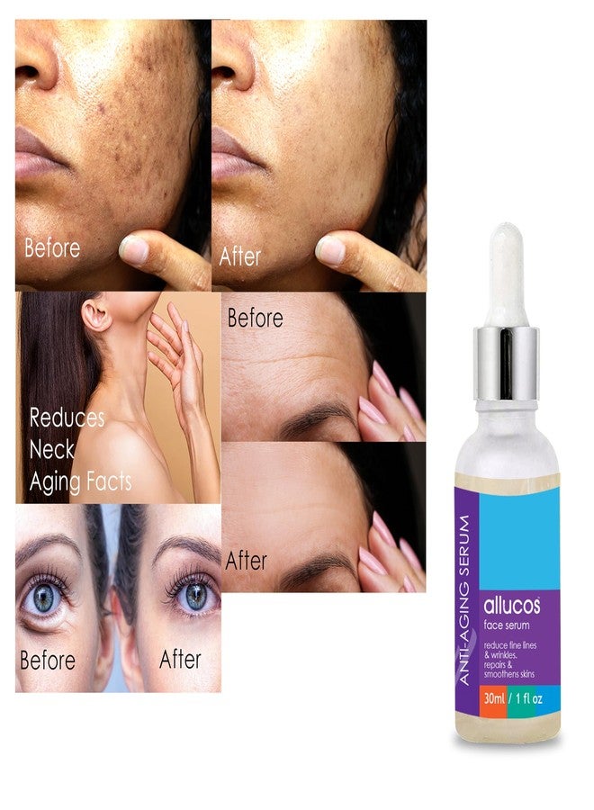 ALLUCOS Anti Aging Serum - Reduce Wrinkles, Fine Lines & Dark Spots - Hydrating & Firming Face Serum for Youthful Skin | Men and Women | Sulphate & Paraben-free | - 30ml - Image 2