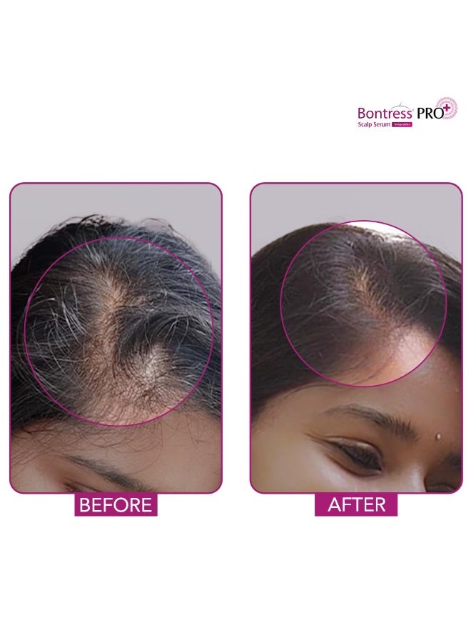 Bontress PRO+ Scalp Serum Fortified with Redensyl, Anagain, Capixyl,Procapil | Hair Serum for Hair Growth & Hair Fall 30ml - Image 5