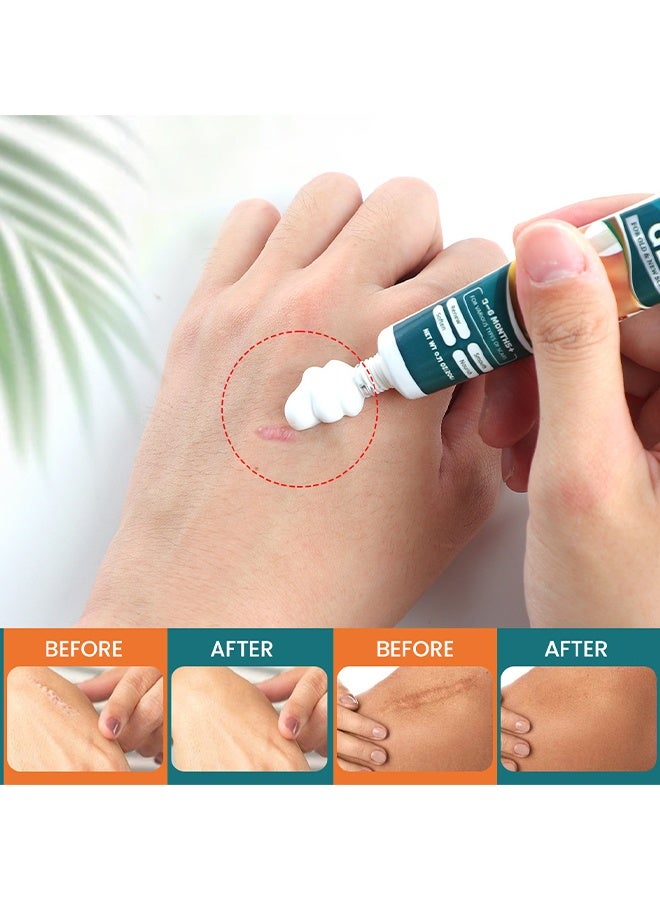 Sumifun Advanced Scar Gel For Old & New Scars, Scar Removal Gel, Advanced Scar Treatment Gel, Repair Mark Gel For Surgical Scars, Nourish Skin Cream, Acne Scars, Stretch Marks, Effective For Old And New Scarss, 20g - Image 4