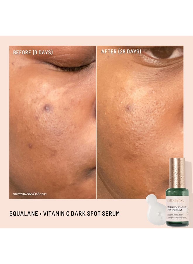 BIOSSANCE - Squalane + Vitamin C Dark Spot Serum. Powerful Lightweight Serum With 10% Vitamin C To Brighten Skin Fade Dark Spots Reduce Pigmentation And Prevent Discoloration (1.01 Ounces) - Image 1